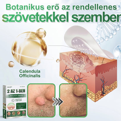 🇭🇺 HAJUEI® ☺️ 2-az-1-ben Mikrotű & Hidrokoloid Tapasz | 🧪 Kiemelkedő Anyajegyek, Pattanások, Lapos Szemölcsök & Bőrkinövések Eltávolítója | Ráncok, Hegek & Bőrhibák Javítása | Láthatatlan Csillag Pattanástapasz Arcra & Testre | 144 db ✨