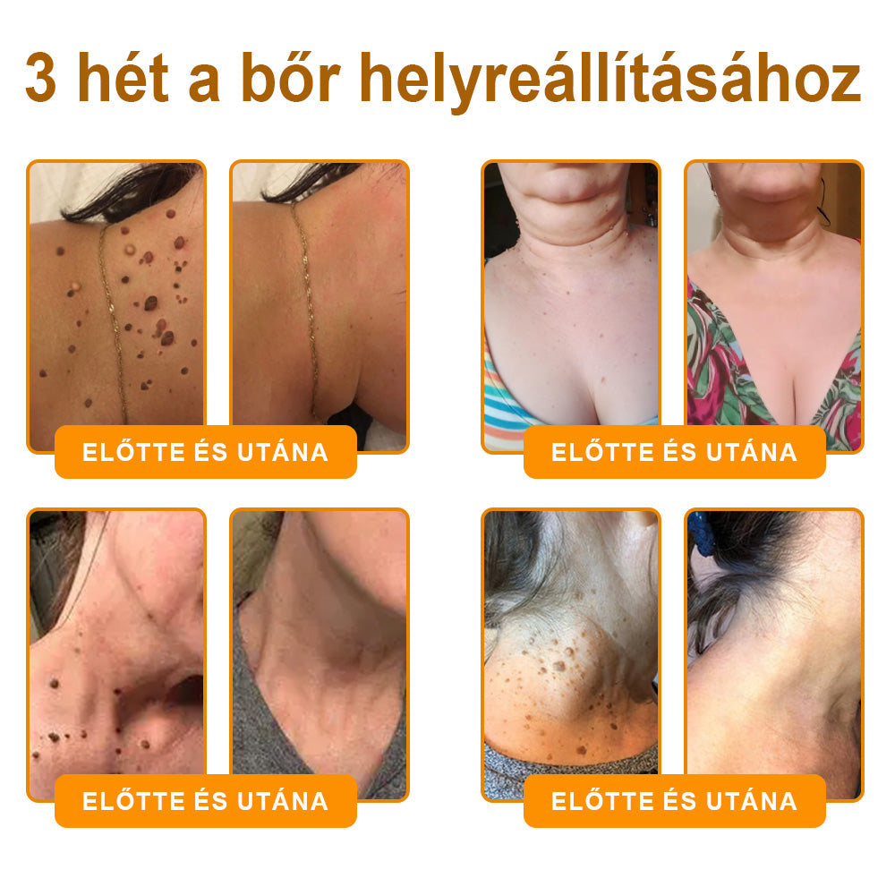 💜 Különleges ajánlat: APKAPK® Krém -50% áron