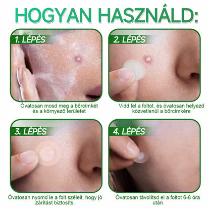 🇭🇺 HAJUEI® ☺️ 2-az-1-ben Mikrotű & Hidrokoloid Tapasz | 🧪 Kiemelkedő Anyajegyek, Pattanások, Lapos Szemölcsök & Bőrkinövések Eltávolítója | Ráncok, Hegek & Bőrhibák Javítása | Láthatatlan Csillag Pattanástapasz Arcra & Testre | 144 db ✨