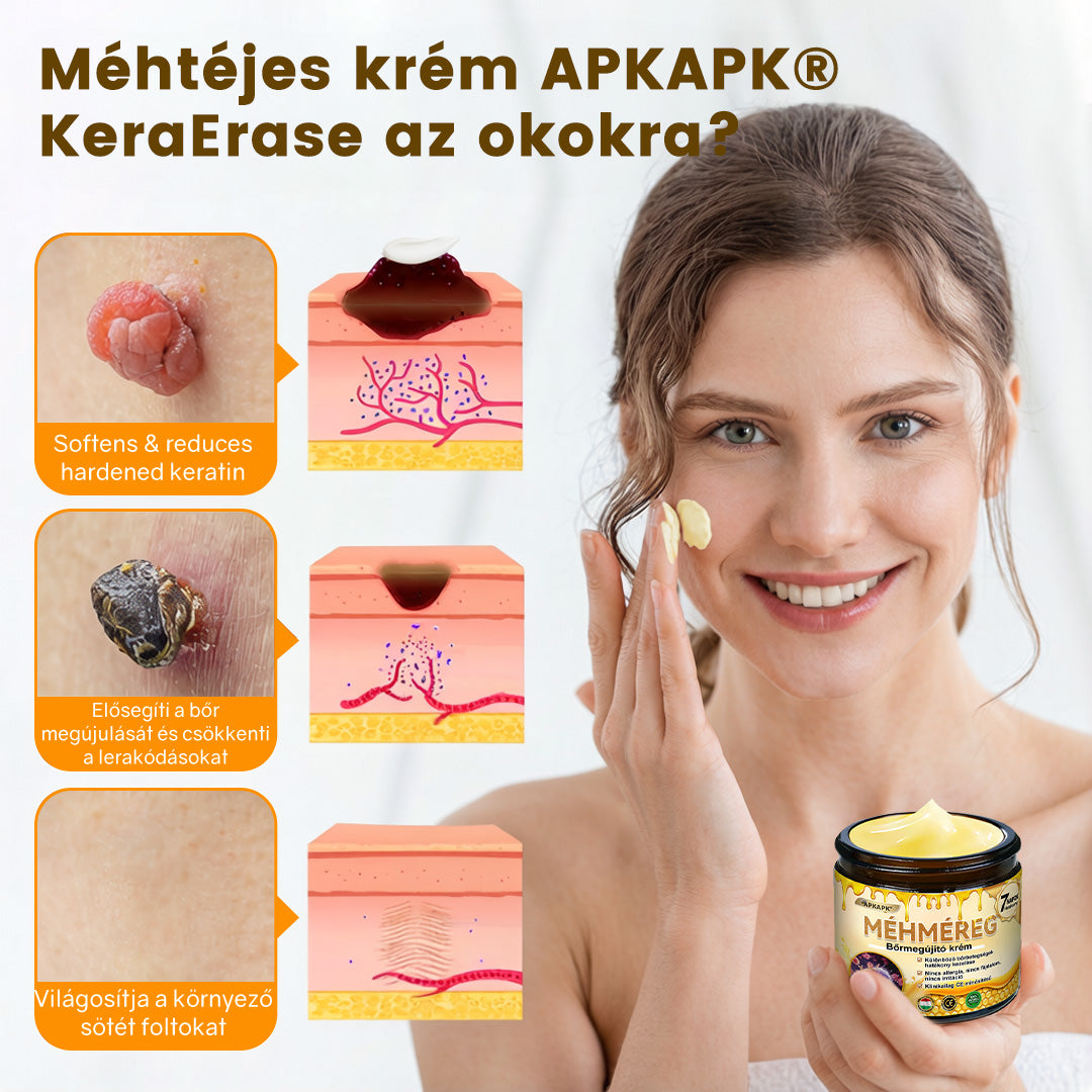 💜 Különleges ajánlat: APKAPK® Krém -50% áron