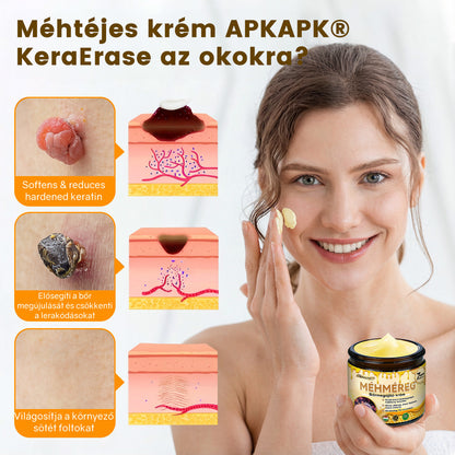 💜 Különleges ajánlat: APKAPK® Krém -50% áron