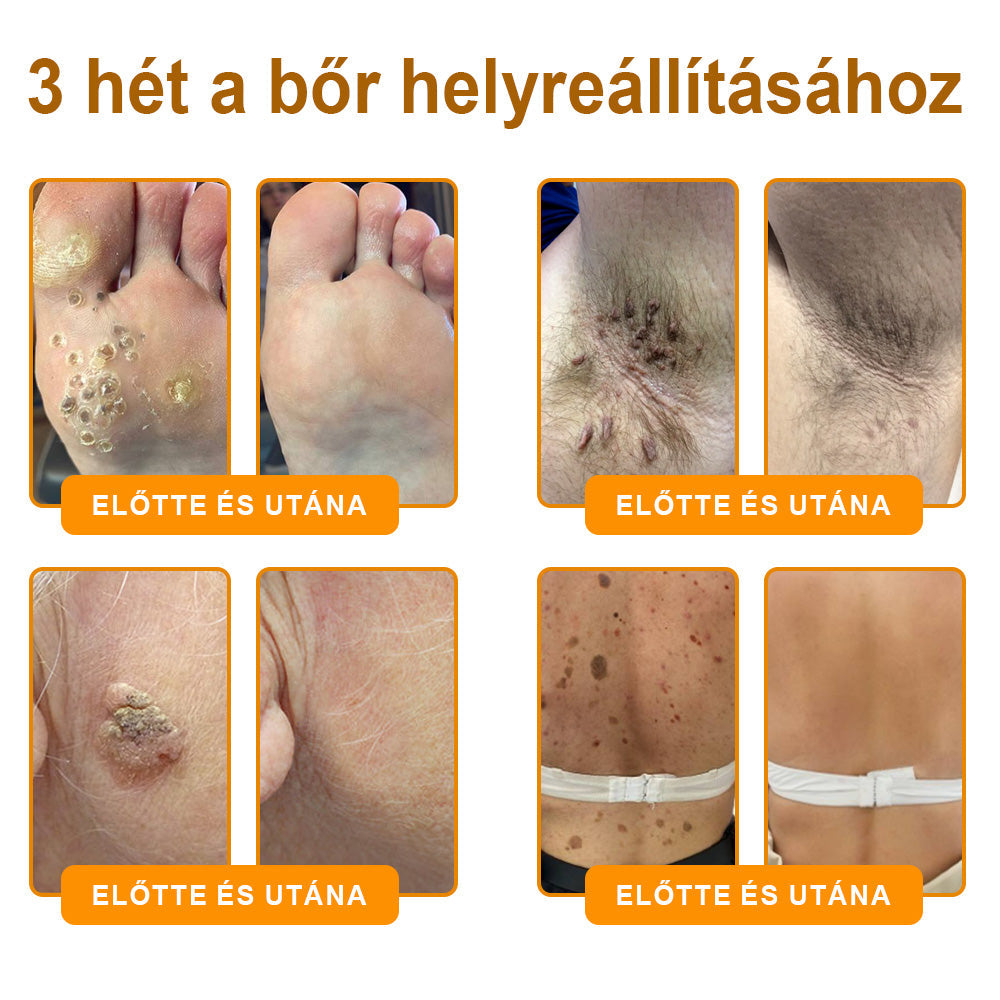 💜 Különleges ajánlat: APKAPK® Krém -50% áron