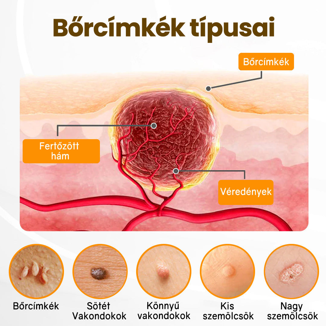 💜 Különleges ajánlat: APKAPK® Krém -50% áron