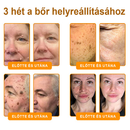 💜 Különleges ajánlat: APKAPK® Krém -50% áron
