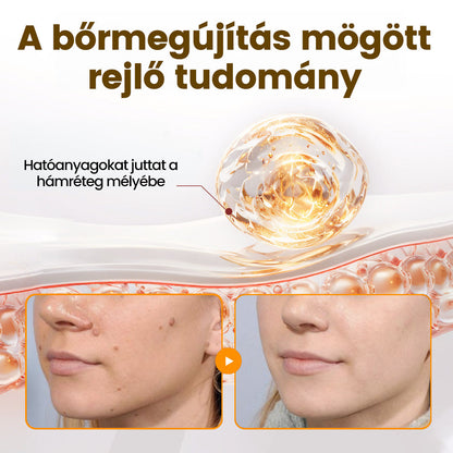💜 Különleges ajánlat: APKAPK® Krém -50% áron