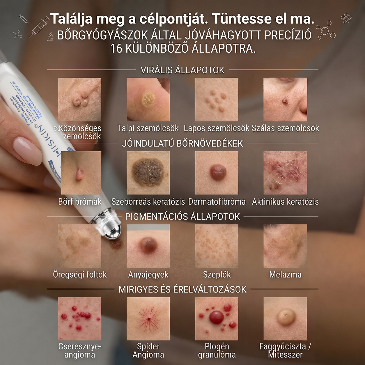 Hivatalos Márkabolt | 🚢🚢 Hiskin® 7 napos Szemölcseltávolító Roll-on Ápoló Folyadék (Fájdalommentes rollerball technológia, hegek nélkül) --🐬