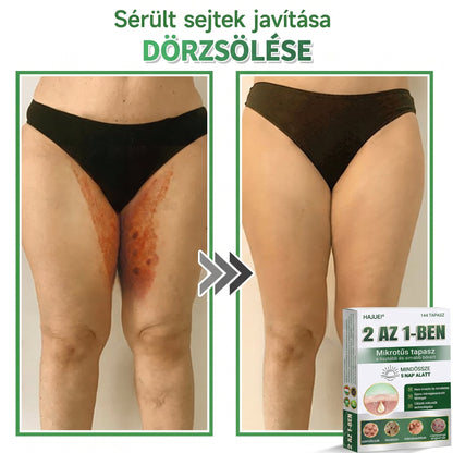 🇭🇺 HAJUEI® ☺️ 2-az-1-ben Mikrotű & Hidrokoloid Tapasz | 🧪 Kiemelkedő Anyajegyek, Pattanások, Lapos Szemölcsök & Bőrkinövések Eltávolítója | Ráncok, Hegek & Bőrhibák Javítása | Láthatatlan Csillag Pattanástapasz Arcra & Testre | 144 db ✨
