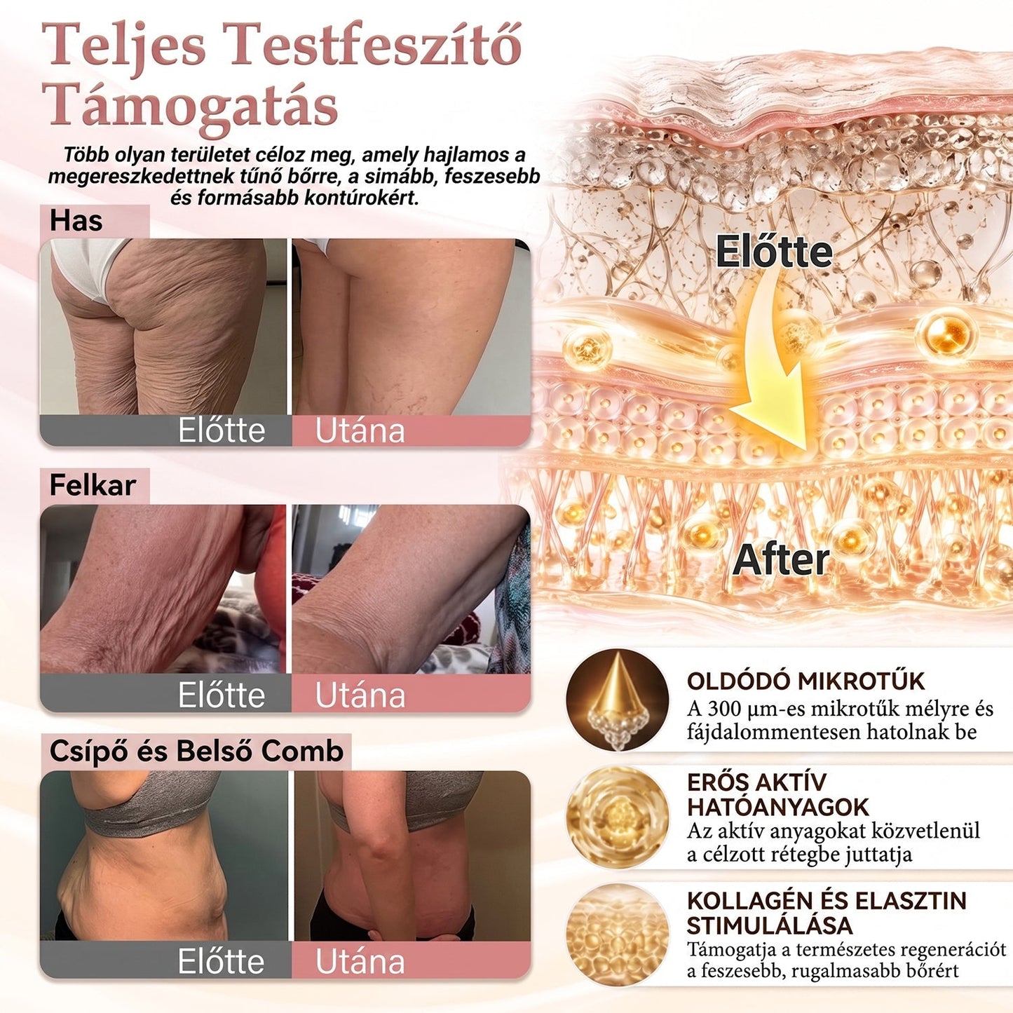 🔥HISKIN® MELLEMELŐ ÉS FESZESÍTŐ MIKROTŰS TAPASZOK