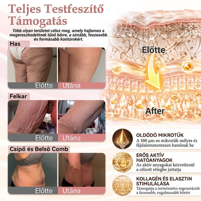🔥HISKIN® MELLEMELŐ ÉS FESZESÍTŐ MIKROTŰS TAPASZOK