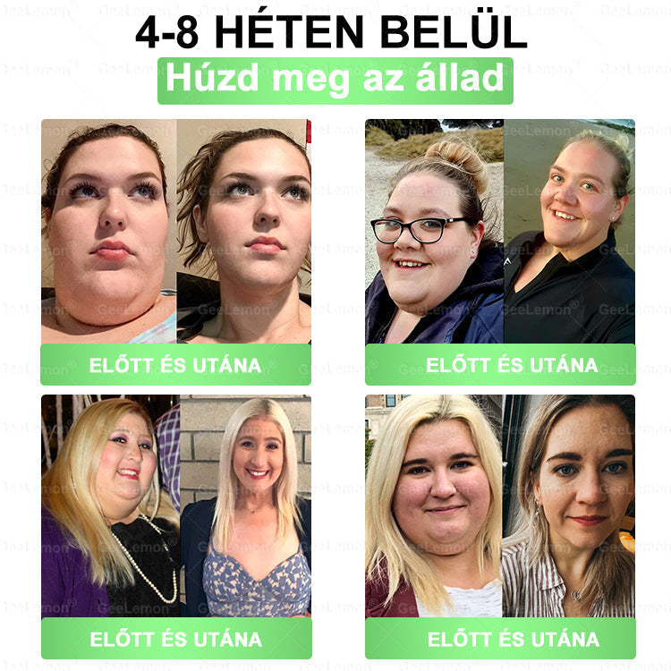 Magyar hivatalos bol 👨‍⚕️ 𝐆𝐞𝐞𝐋𝐞𝐦𝐨𝐧® 8 az 1-ben karcsúsító nano mikrotűs tapasz 🇭🇺 Napi egyszeri használat ✅ 7 napon belül látható eredmény – Alkalmas elhízás, szív- és érrendszeri problémák, cukorbetegség és ízületi problémák kezelésére.