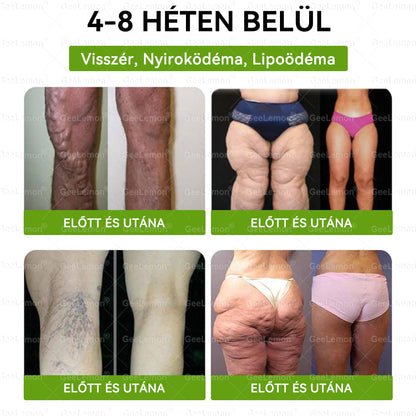 Magyar hivatalos bol 👨‍⚕️ 𝐆𝐞𝐞𝐋𝐞𝐦𝐨𝐧® 8 az 1-ben karcsúsító nano mikrotűs tapasz 🇭🇺 Napi egyszeri használat ✅ 7 napon belül látható eredmény – Alkalmas elhízás, szív- és érrendszeri problémák, cukorbetegség és ízületi problémák kezelésére.
