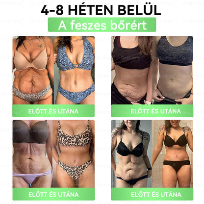 Magyar hivatalos bol 👨‍⚕️ 𝐆𝐞𝐞𝐋𝐞𝐦𝐨𝐧® 8 az 1-ben karcsúsító nano mikrotűs tapasz 🇭🇺 Napi egyszeri használat ✅ 7 napon belül látható eredmény – Alkalmas elhízás, szív- és érrendszeri problémák, cukorbetegség és ízületi problémák kezelésére.