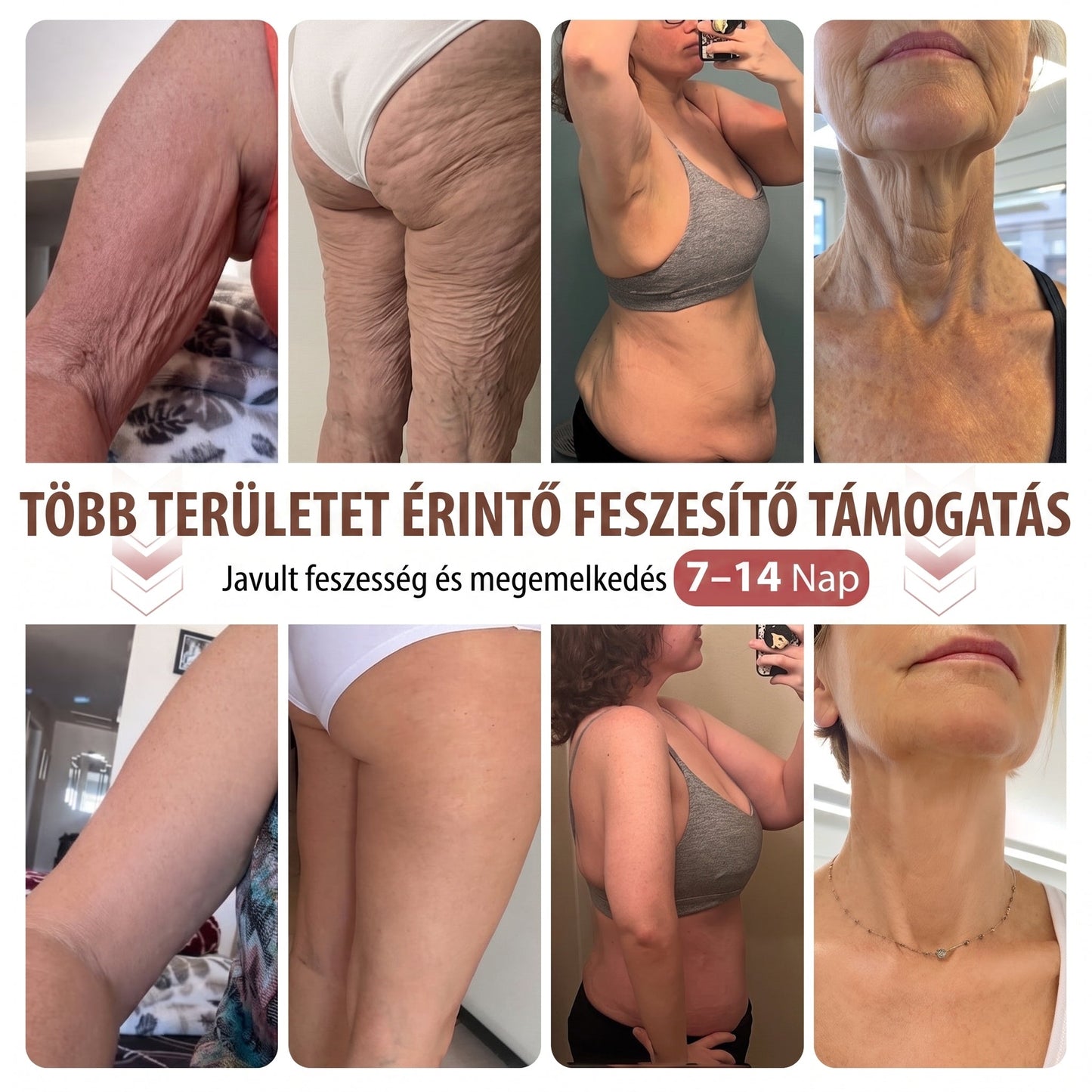 🔥HISKIN® MELLEMELŐ ÉS FESZESÍTŐ MIKROTŰS TAPASZOK